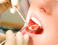 手厚い歯周病治療