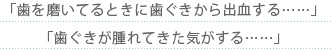 「歯を磨いてるときに歯ぐきから出血する……」「歯ぐきが腫れてきた気がする……」